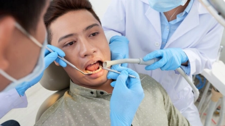 third-molar-removal